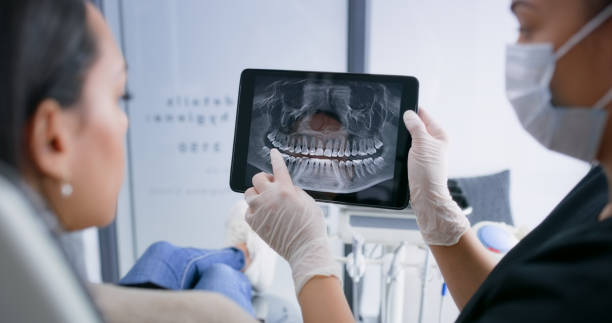 Licensed Dental Implants service in Cleveland, NC - Smile Center Dentistry