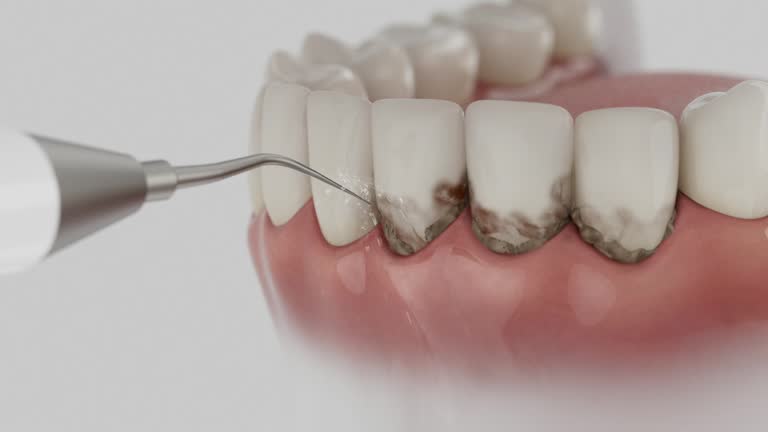 Reliable Dental Implants contractor in Cleveland, NC by Smile Center Dentistry